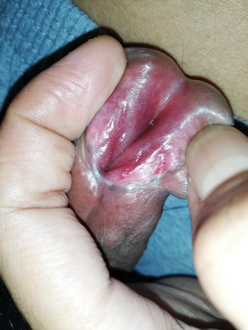 Is anyone here using paypal?  #princealbertpiercing #papiercing #princealbert #piercing #piercedcock<a href="/tag/princealbertpiercing"class="tags">#princealbertpiercing</a><a href="/tag/piercing"class="tags"><span>#piercing</span></a><a href="/tag/pa"class="tags"><span>#pa</span></a><a href="/tag/bigdick"class="tags"><span>#bigdick</span></a><a href="/tag/dick"class="tags"><span>#dick</span></a><a href="/tag/princealbert"class="tags"><span>#princealbert</span></a><a href="/tag/teampa"class="tags"><span>#teampa</span></a>