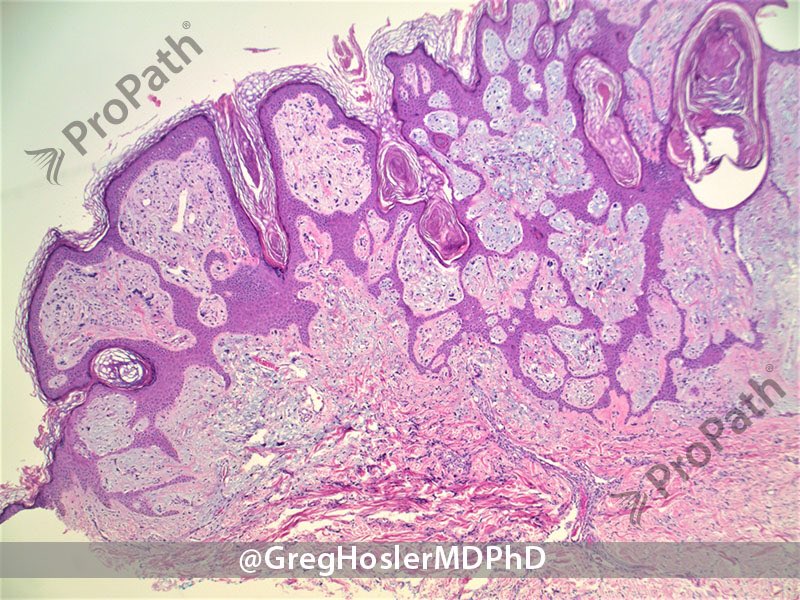 Gregory A Hosler tweet media