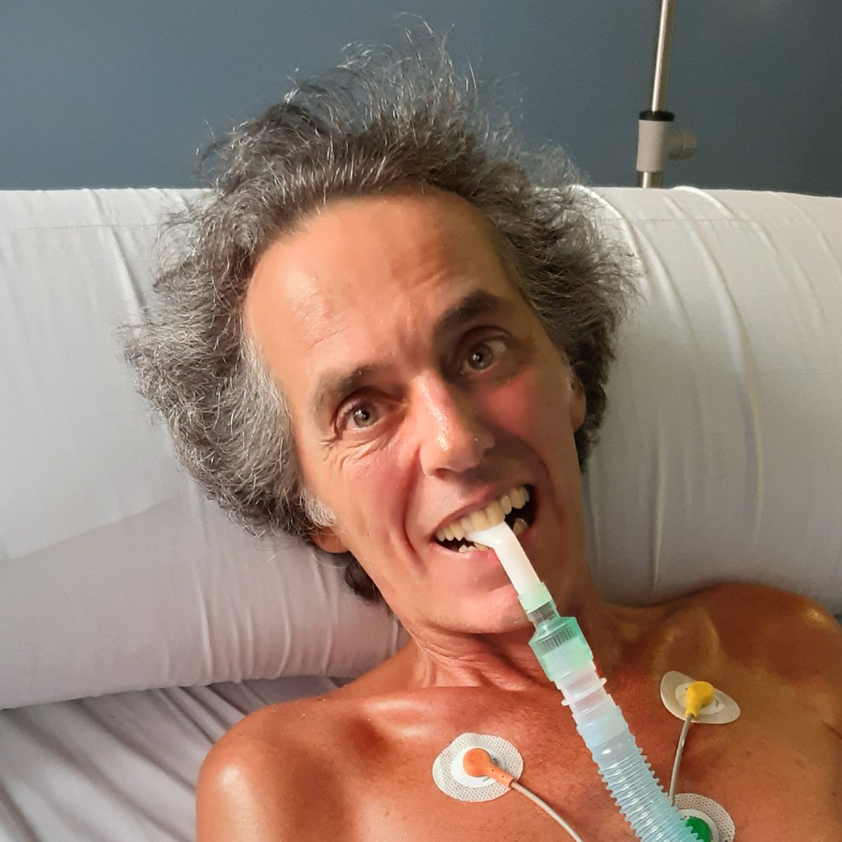 #Nurown #Nurowneurope #NurOwn_UAE #NurOwnworld #nurowncanada  #ENDALS

A) We ask to <a href="/US_FDA/">U.S. FDA</a> Approve #Nurown
B) We ask to <a href="/EMA_News/">EU Medicines Agency</a> Approve #Nurown