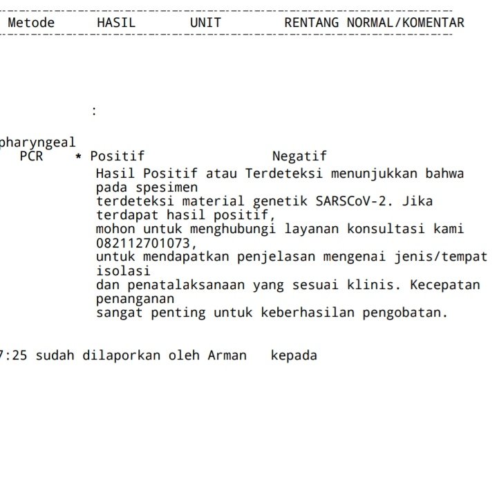 ventableu's tweet photo. Gue ga bosen untuk ngingetin kalian, di luar sana masih banyak OTG berkeliaran yg scr ga sadar menularkan ke org lain. 

Contoh gue, ga bergejala, suhu badan normal. Berapa banyak OTG yg tau kalo mereka bervirus? Dan brp banyak sih yg sadar untuk mengisolasi diri? Stay safe. https://t.co/76I97iE7KZ