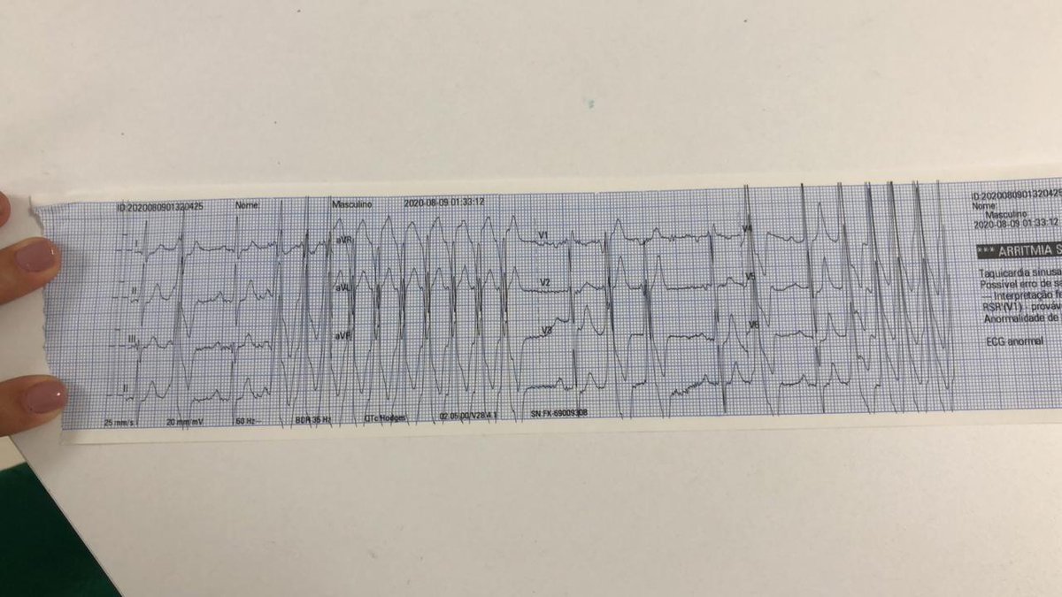 Renner Raposo Pereira tweet media