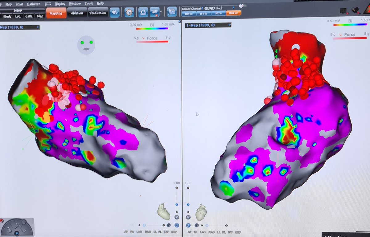 Renner Raposo Pereira tweet media