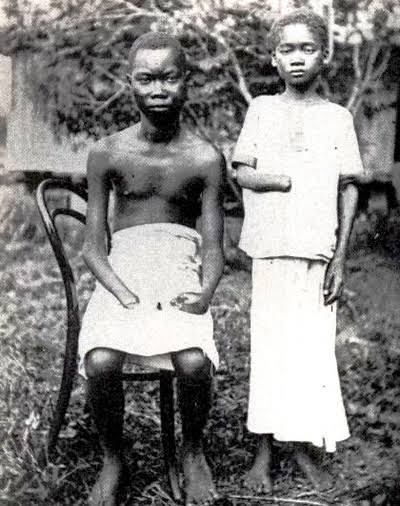 A common approach was to mutilate children in case their parents didn’t collect enough rubber. Soldiers often came back from raids with baskets full of chopped-off hands. Villages that resisted were destroyed entirely. Since men were forced to collect rubber no one was farming.