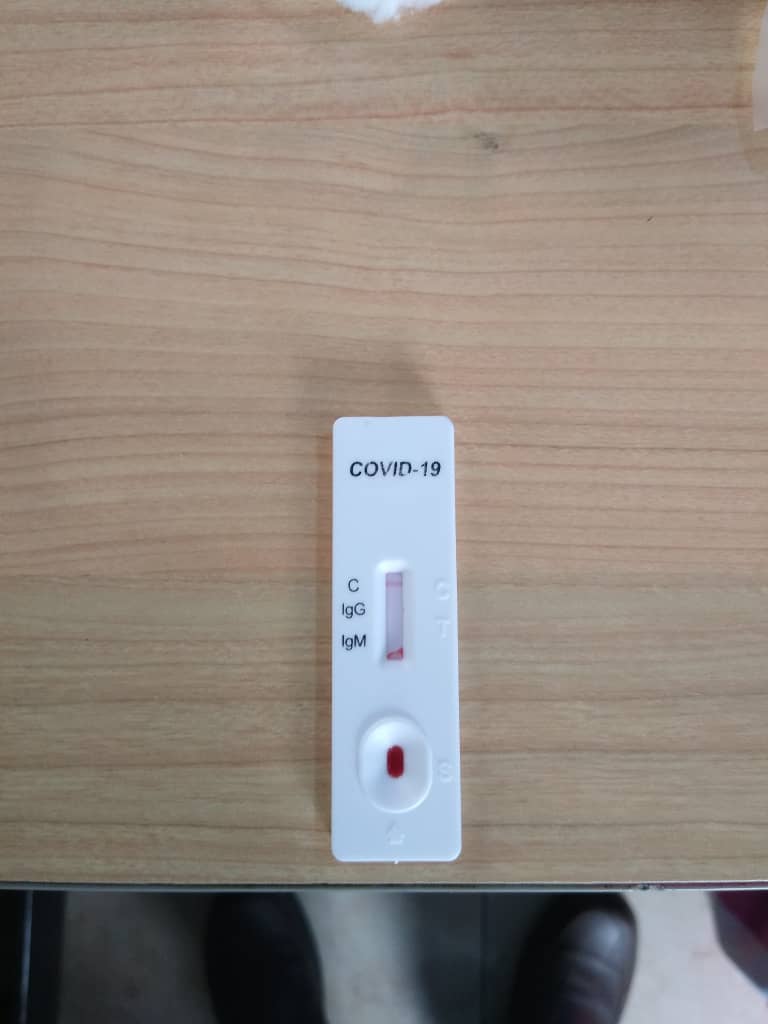 somosnoticiacol's tweet photo. #LoUltimo | Familiares de pacientes sospechosos de COVID-19 denuncian que en el municipio Lagunillas ningún ente oficial @HospitalPedroG @AmbulatoriOjeda @LeonidasAlcalde ni los CDI, ni los Barrio Adentro tienen pruebas rápidas de detención de este mortal virus #CiudadOjeda https://t.co/OQ7uCyK1Vf