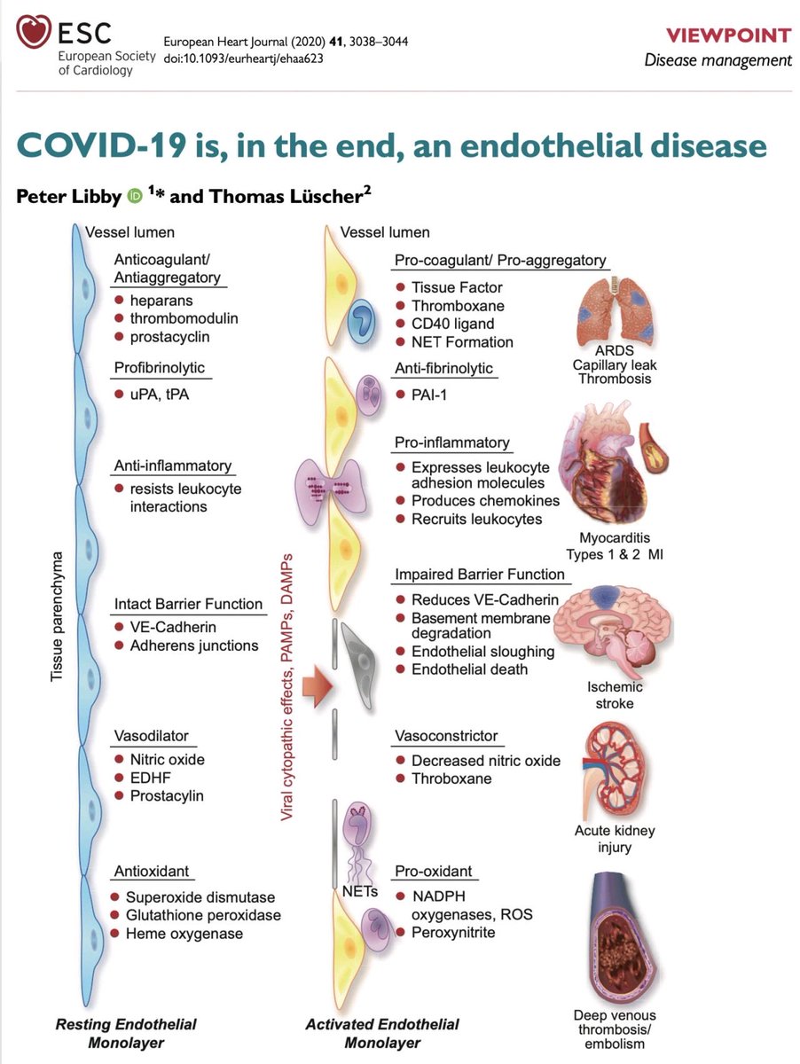 EchoSoliman's tweet image. #COVID-19 as an endothelial disease. An insightful viewpoint from Peter Libby and @TomLuscher 

academic.oup.com/eurheartj/arti…

#cardiotwitter #CardioEd