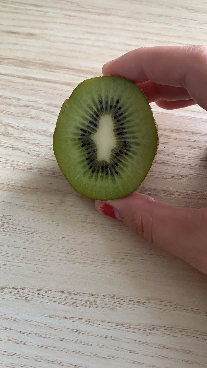 MariaHurryUp's tweet photo. Dale rt al kiwi de la suerte o tendrás 7 años de desgracias. https://t.co/YJKTupQDzc