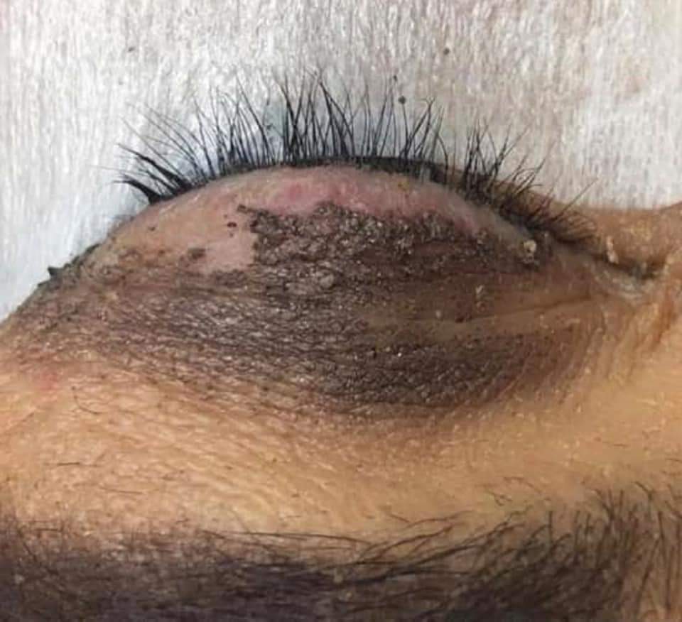LaylaLaurenLeo's tweet photo. Ladies be careful ... 

#LashFail #GirlsTalkZA https://t.co/0mhvGXTtPW