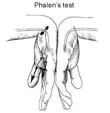sasutra3's tweet photo. Procedimiento y valoración de la prueba de #Phalen
#Mediano #Nervio #Muñeca #Fisioterapia
https://t.co/10JeS1GdHY https://t.co/kn7oD45pTu