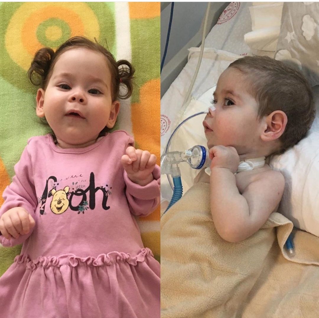 Merhaba sevgili <a href="/haluklevent/">Haluk Levent ( Ahbap Ekibi )</a> , fotograftaki küçük kızımız Zeynep İnci <a href="/zeynepinciSMA/">Zeynep İnci SMA</a>, SMA tip 1 ile mücadele ediyor. Tedavisi Zolgensma isimli gen tedavisi Amerika'da .Bu yüksek maliyetli tedaviye ulaşmak için hepimizin desteğine ihtiyacı var. Siz de bize ses olur musunuz 🙏