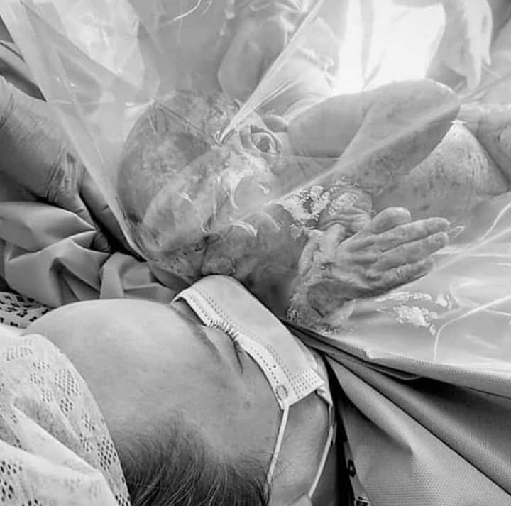 cesahuma's tweet image. Stop #fakesnews ⚠️
Depuis 2 jours cette image circule et suscite de l'indignation. 
👉🏼 Il s'agit d'un champ opératoire transparent dans un #blocopératoire pendant une #césarienne pour que la mère puisse assister à la naissance de son enfant, et non d'une protection #COVIDー19 👇🏼