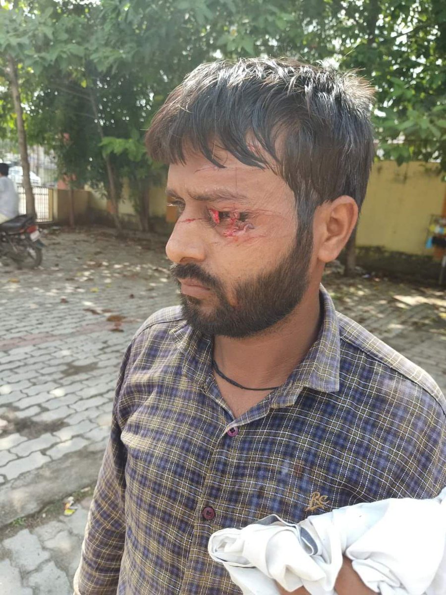 NaushadDrx's tweet photo. बर्बर और बेलगाम हो गई है #गोण्डा_पुलिस
जुआरियों की आड़ में फोड़ दी बेगुनाह की आंख
शर्मनाक और घोर निंदनीय
@dgpup @Uppolice @digdevipatan @CMOfficeUP @myogiadityanath @ARUsmaniJourna1 https://t.co/rroasmu9Ya