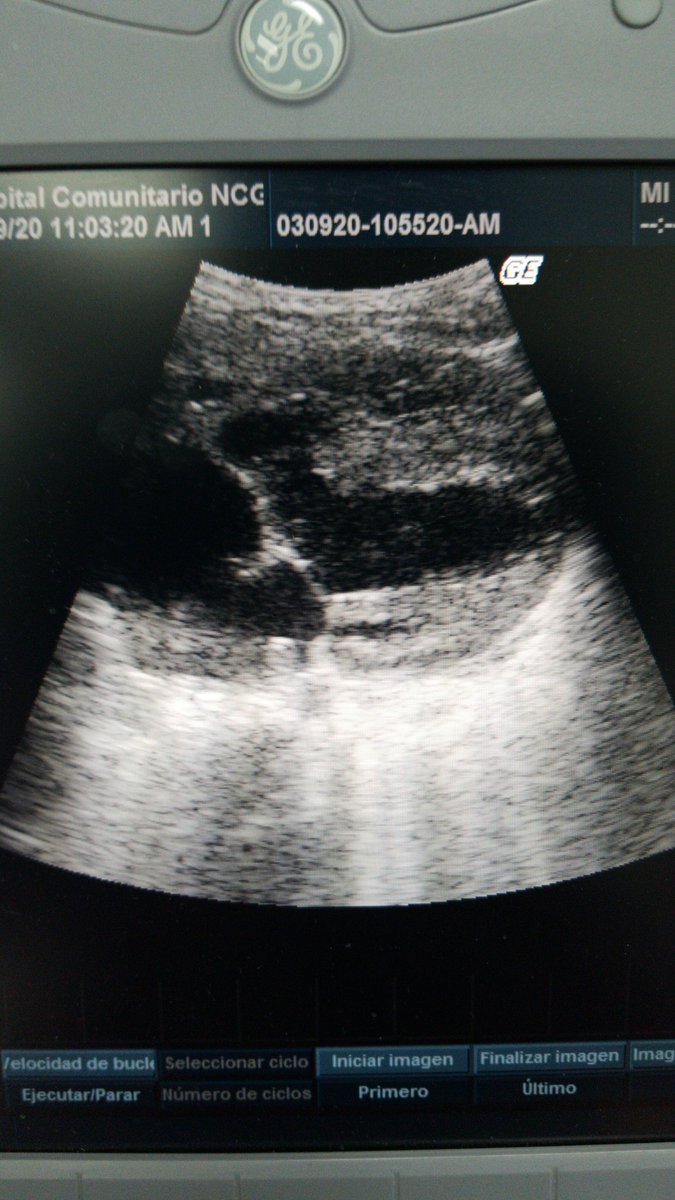 Issco_Alarcon22's tweet photo. Aplicando las enseñanzas de @DrRockPed improvisando con un usg para gine 😅😅😅😅 #CardioLife https://t.co/PDF165w0js