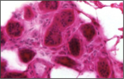 AACancerOrg's tweet photo. Congratulations to Professor Justin Stebbing and team at Imperial College London for breakthrough demonstrating for the first time some specific links between pregnancy, age and breast cancer, in study funded by AAC and pre-printed online today. Read more https://t.co/RtaTXwCe1r https://t.co/2ClCRqoUuE