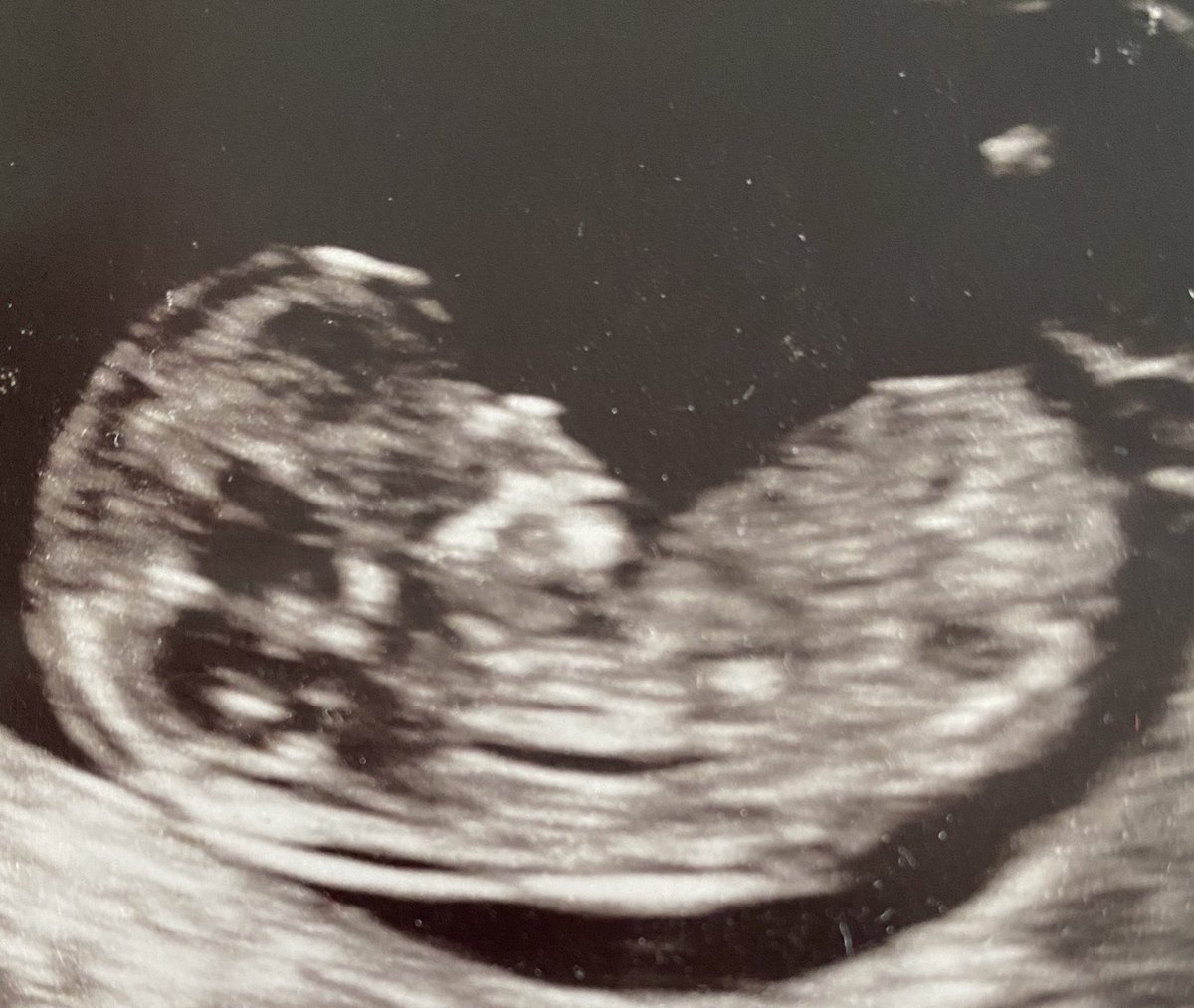 AdamJSmithy's tweet photo. 💙 I’M GONNA BE A DAD! Buzzing! 
Baby boy due in Jan 2021! 

Any advice on Parenthood people? 🤔 Go....

#Dadtobe #babyboy #baby #fatherhood #buzzing https://t.co/cx2mfpG0xm