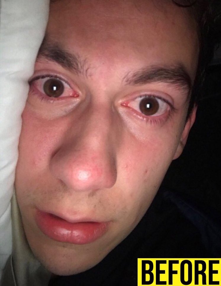 lilsasquatch66's tweet photo. How the Travis Scott burger saved my life: My Story

Tonight at 7 https://t.co/OxuFc89WKI