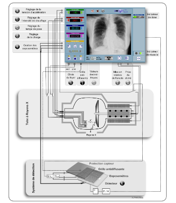 UpbmAsso's tweet photo. APPRENDRE A REALISER UNE #RADIOGRAPHIE A L’AIDE D’UN SIMULATEUR NUMERIQUE
https://t.co/SInJ6HmWhn https://t.co/TfxMQxonmk