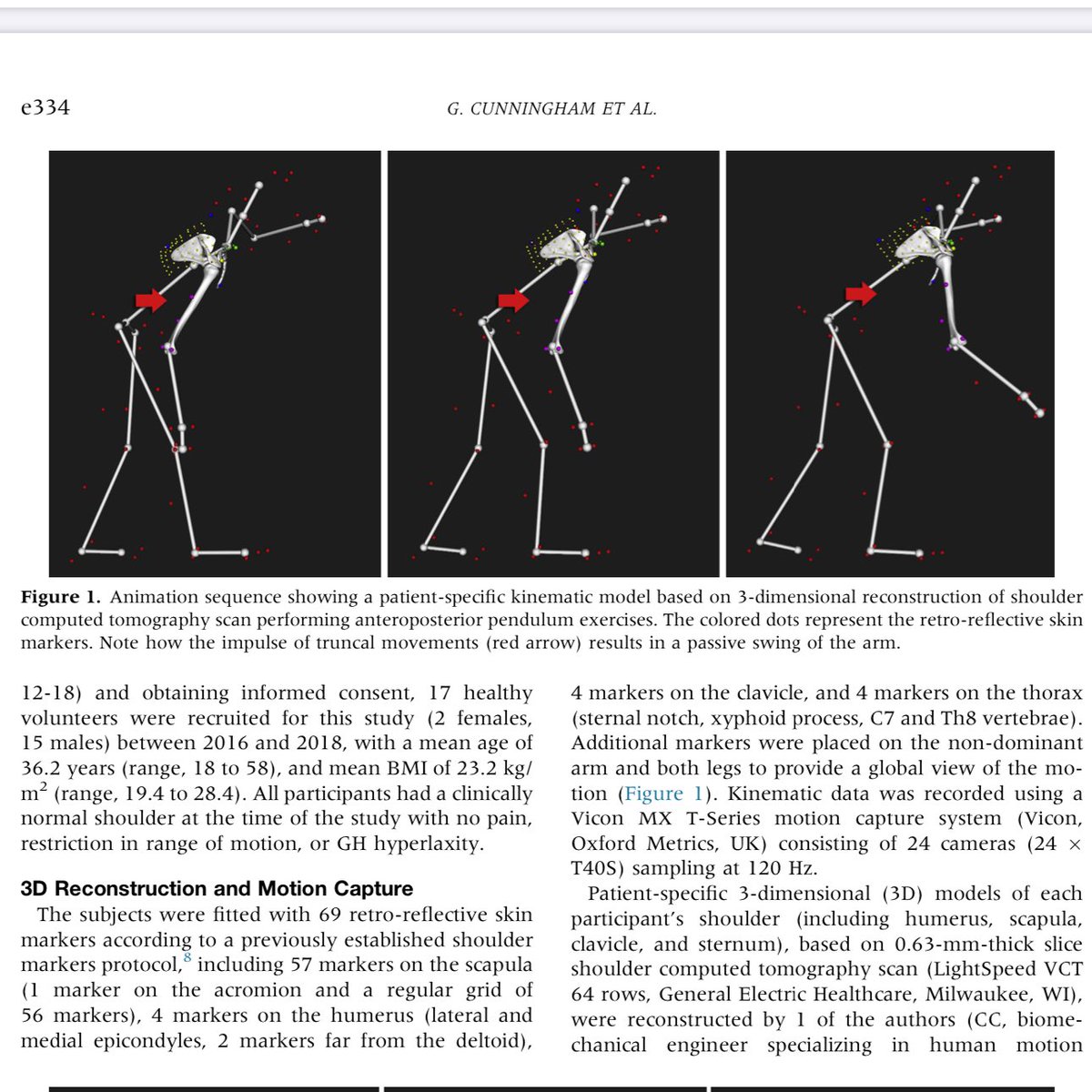 AdamMeakins's tweet photo. Pendulum exercises do not mobilise the glenohumeral joint or scapula much at all, and maybe limited in helping restore shoulder mobility! https://t.co/0VopAWOMRf #FreeAccess https://t.co/abSvzdTWou