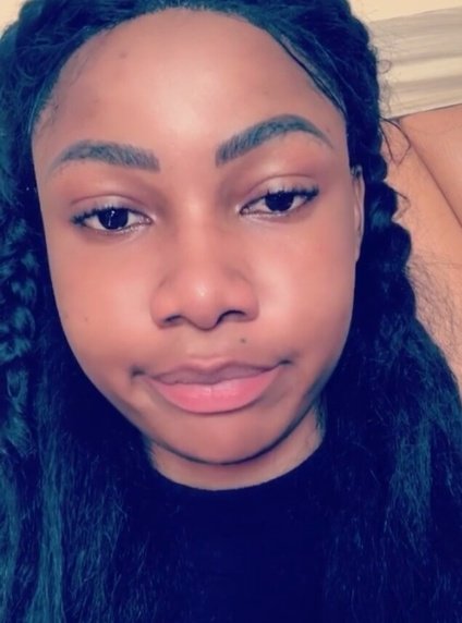 joyrijazlin's tweet image. Stan Tacha for clear skin 
#Tachaholic 
#TachaBackHurts