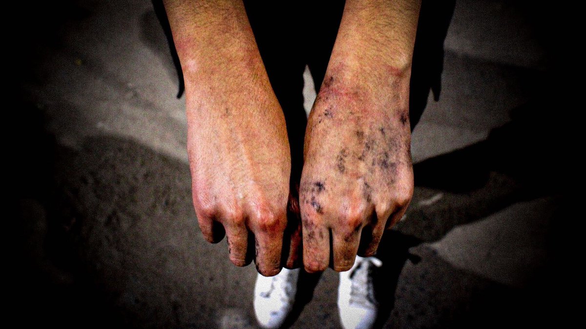 brujasdelmar's tweet photo. #LaPolicíaNoMeCuida

05/09/20: 25 feministas detenidas arbitrariamente, golpeadas y amenazadas por policías en Ciudad Juárez, Chihuahua.

22/08/20: 23 feministas detenidas, desparecidas por horas, golpeadas y agredidas sexualmente en León, Guanajuato. https://t.co/8COS8zJPYa