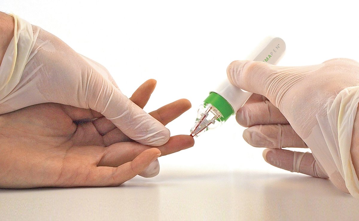 trajanscimed's tweet image. Advantages of #hemaPEN #blood microsampling validated for therapeutic drug monitoring in Royal Society of Chemistry’s Analyst journal. #drugmonitoring @Laura_Mercolini @PTA_Lab @Michele_Protti trajanscimed.com/blogs/news/adv…