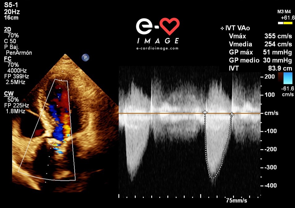 ecardioimage's tweet photo. Las #valvulopatias son parte del día a día, por lo que su correcta cuantificación es mandatoria para un diagnóstico y manejo correctos. En #ecardioimage te daremos los #trucos, sin guardarnos nada, para que optimices tu capacidad diagnóstica por imágenes🔥💥
@tavoave @wikimagen https://t.co/qZP3BmArkF