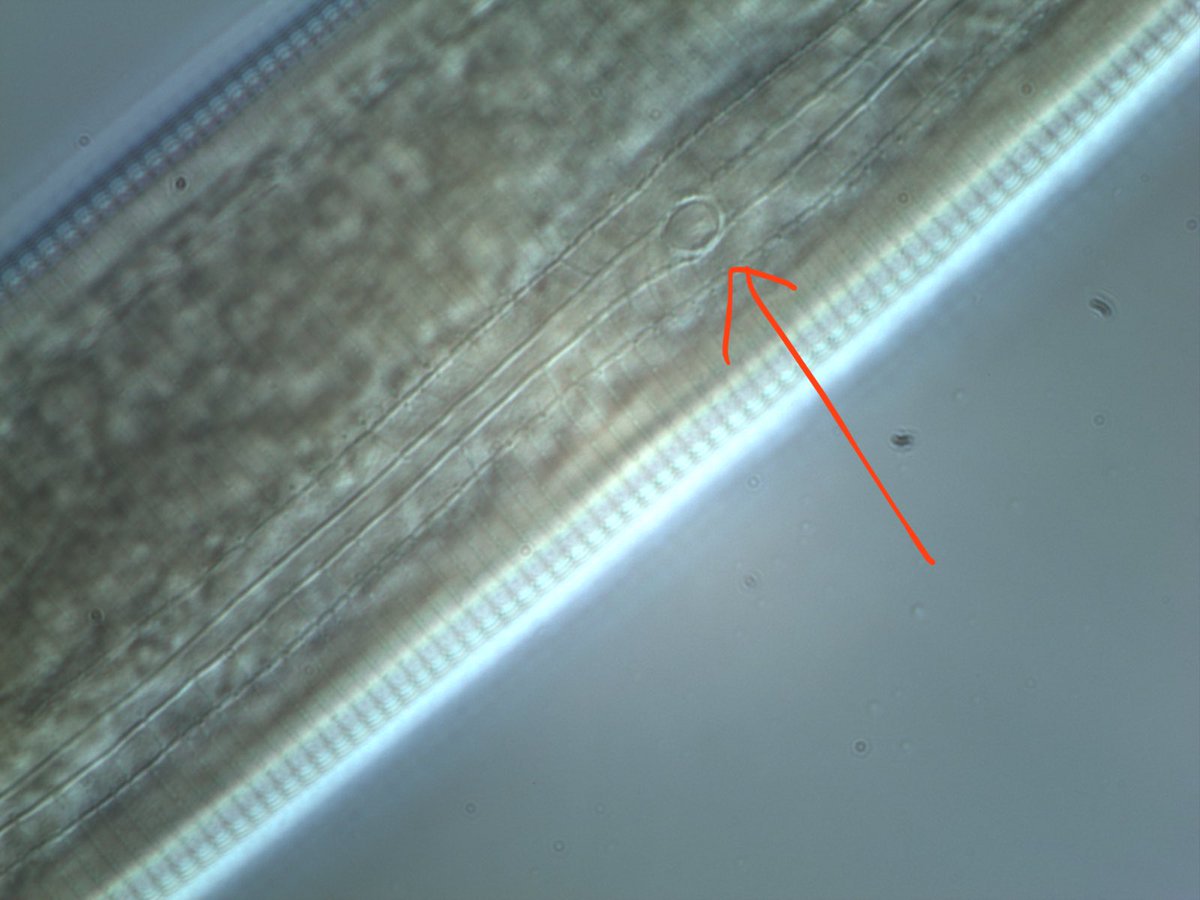 Do you wonder how nematodes sense their environment? Pictured with a red arrow is a phasmid (situated between the lateral lines), which is a caudal sense organ present in some nematodes (Secernentea). The size and location of these structures are useful in #nematode ID.