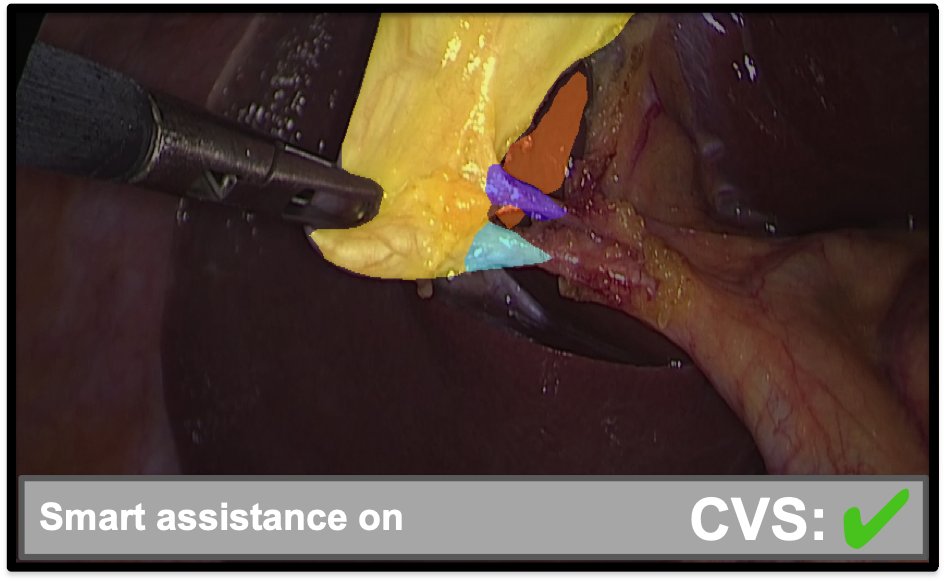 🚀 Le professeur Nicolas Padoy a reçu l'une des 43 chaires nationales en Intelligence Artificielle pour son projet AI4ORSafety.

Site web : camma.u-strasbg.fr

En collaboration avec <a href="/CHRUStrasbourg/">CHRU Strasbourg</a>, <a href="/IHUStrasbourg/">IHU Strasbourg</a>, <a href="/unistra/">-</a>, <a href="/regiongrandest/">Région Grand Est</a>  et l'<a href="/IrcadFrance/">IrcadFrance</a>