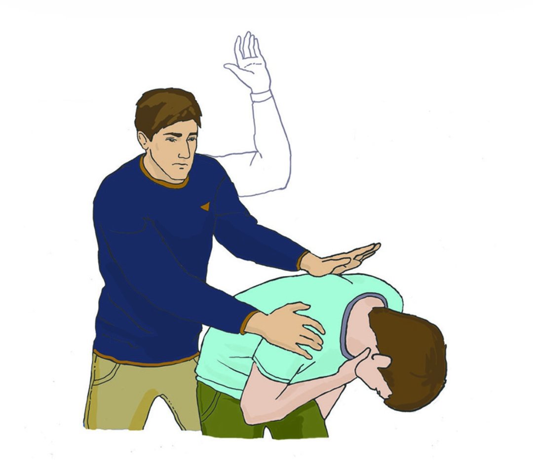 Как помочь подавившемуся человеку. Прием генри геймлиха. Если человек подавился прием геймлиха. Если ребенок подавился первая помощь. Если человек подавился и задыхается что делать первая помощь.