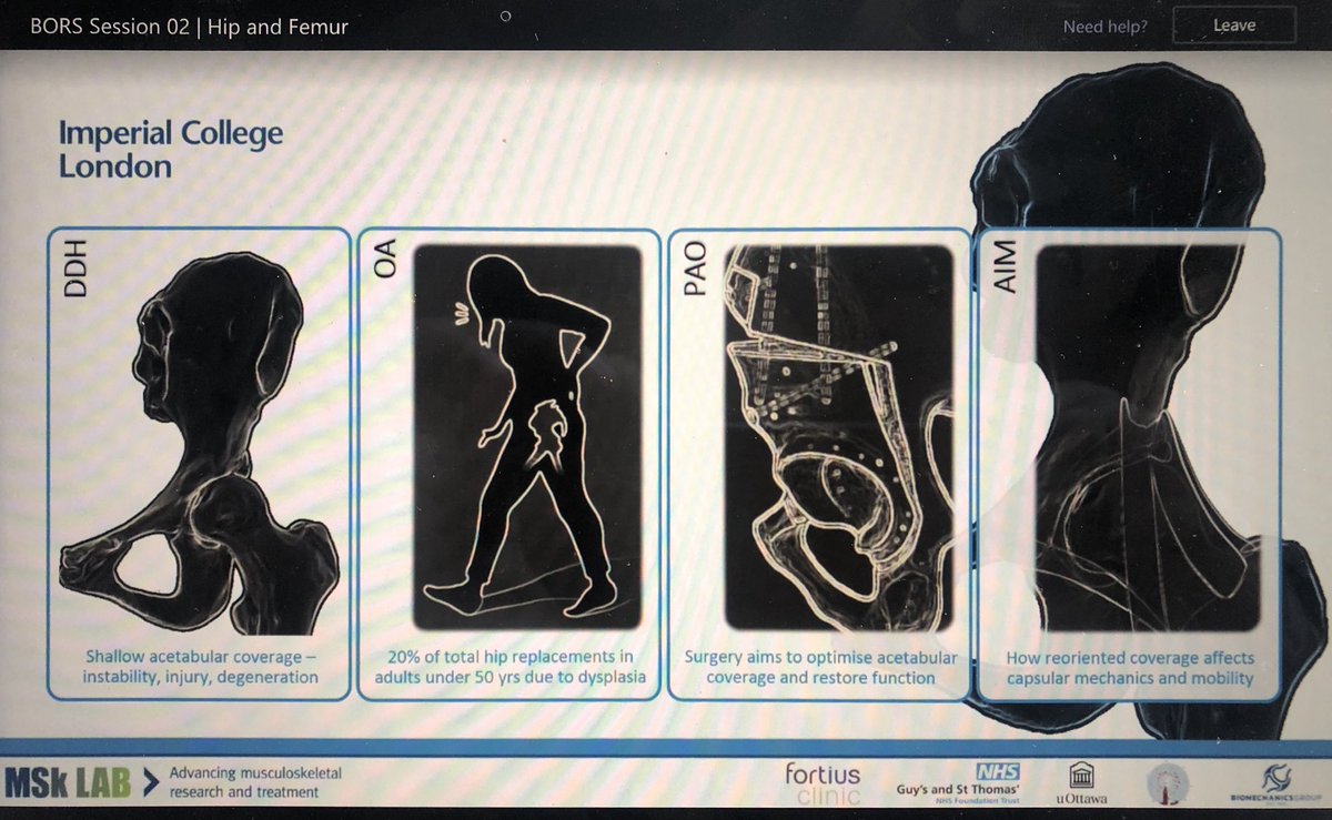 Pranai_B's tweet photo. Excellent presentation by @KcGeoffreyNg on #Capsular #Mechanics following #PAO @BritishORS #Virtual Meeting - time to consider managing the #capsule in these patients?
@mbankes @ISHASociety @HipSymposium @ajaymalviya https://t.co/PFNBHMOEKt