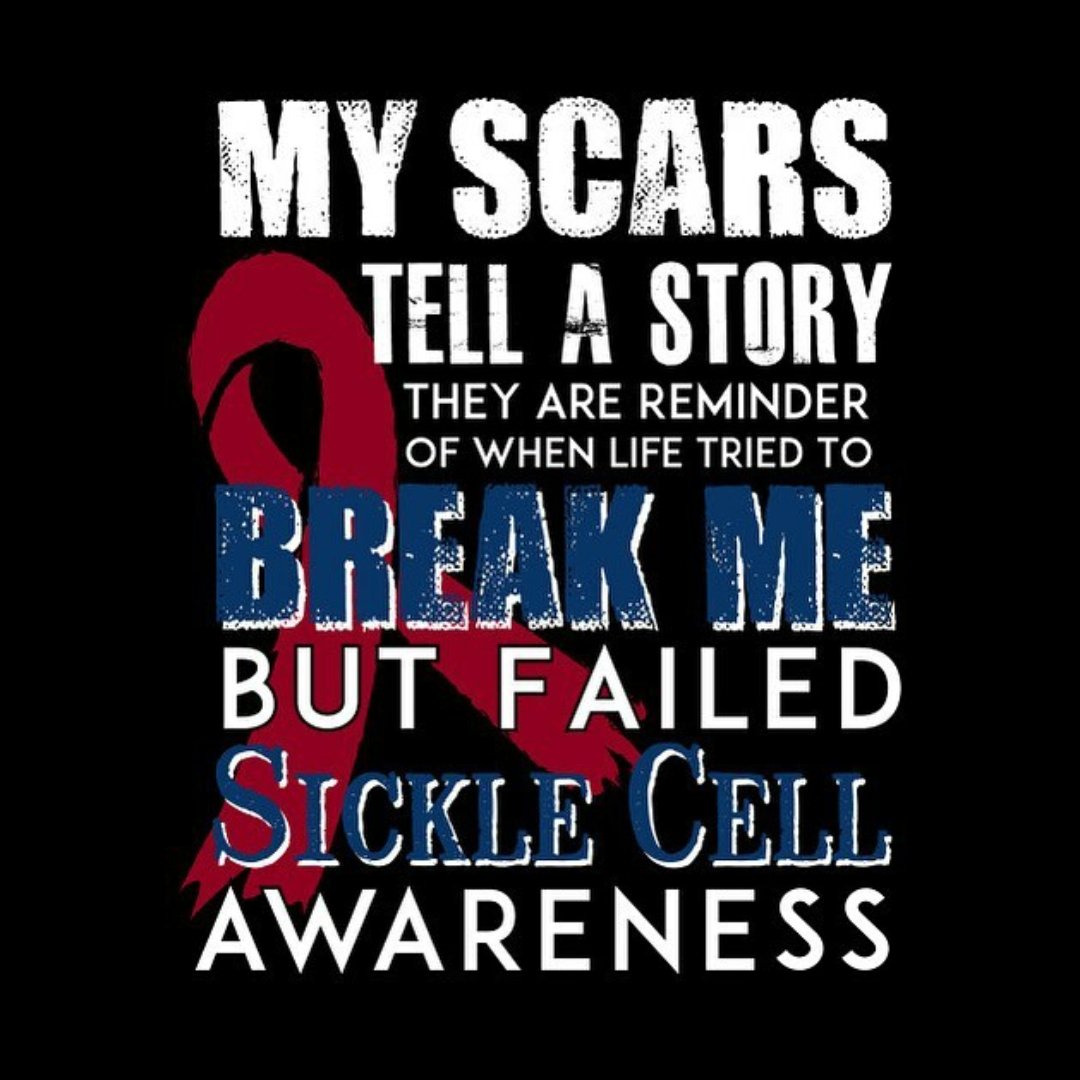 Sicklecell_cg's tweet photo. Every scar, tells every story of every battel we have won.
#painnotagain
#Chhattisgarh
#stopsicklecell https://t.co/VB4JtQflpu