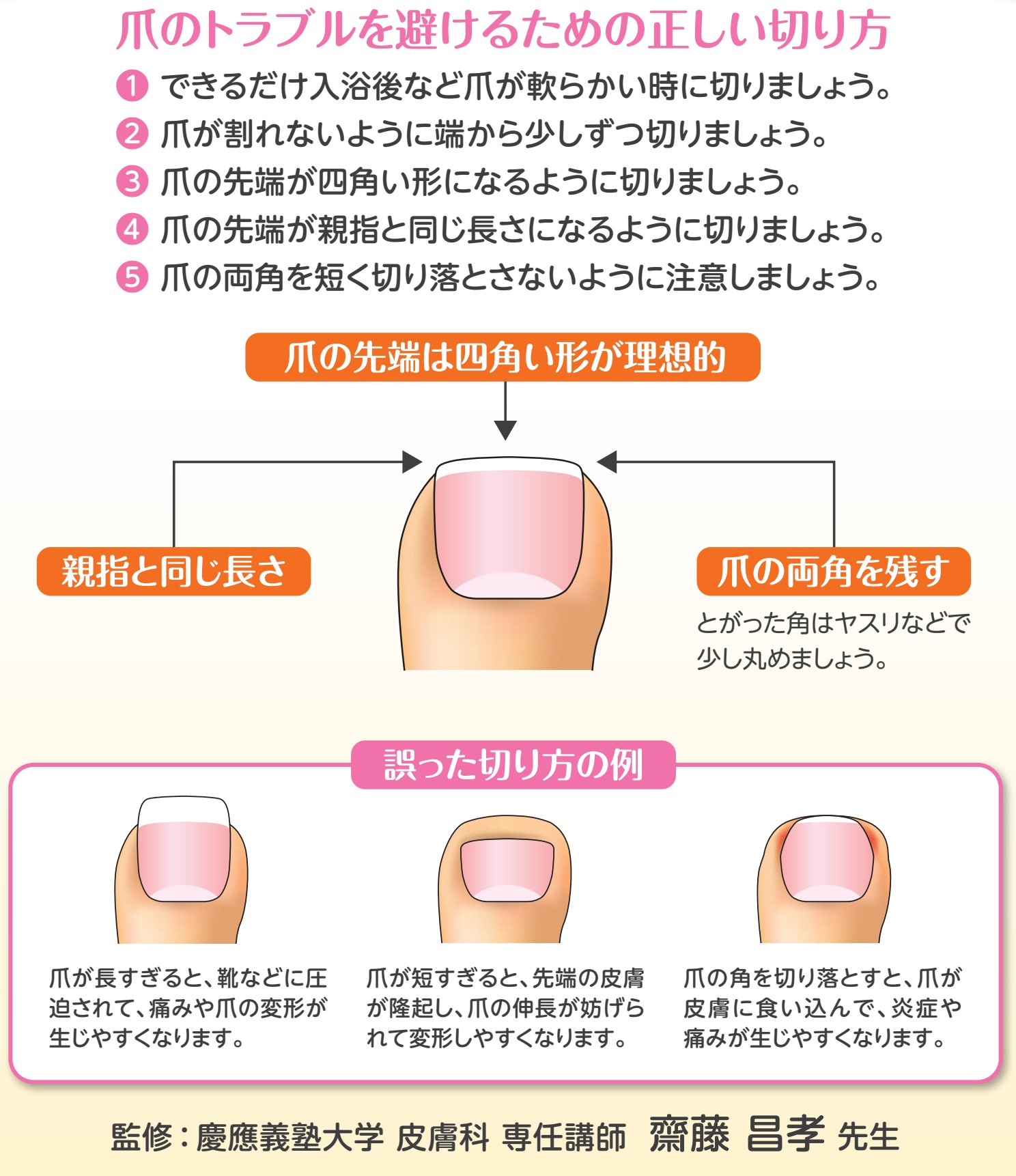 Twitter 上的 やさひふ 皮膚科専門医 医学博士 Lumedia編集長 まず 爪 が長すぎると水虫が住みやすくなるので こまめに切るようにします ただ 単に短く切るだけだと 今度は巻爪の原因になります 画像を添付しますが 爪 は真っ直ぐ切って スクエアカット 皮膚
