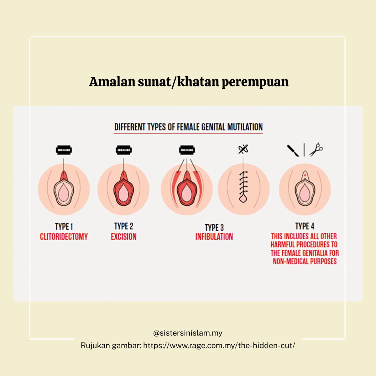 Sisters In Islam Auf Twitter Oleh Itu Kami Telah Menukarkannya Ke Perkataan Jenis Untuk Menerangkan Jenis Jenis Sunat Khatan Perempuan Kami Ingin Memohon Maaf Atas Kesilapan Ini Dan Telah Pos Semula Dengan Pembetulan Tersebut