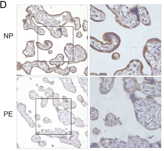 ReprodJournal's tweet photo. Are you interested in preeclampsia? Don't miss this new research on the mechanisms underlying trophoblast apoptosis and proliferation #PDIA3.

https://t.co/lyk7d4TiHR https://t.co/bdDtpll4XE
