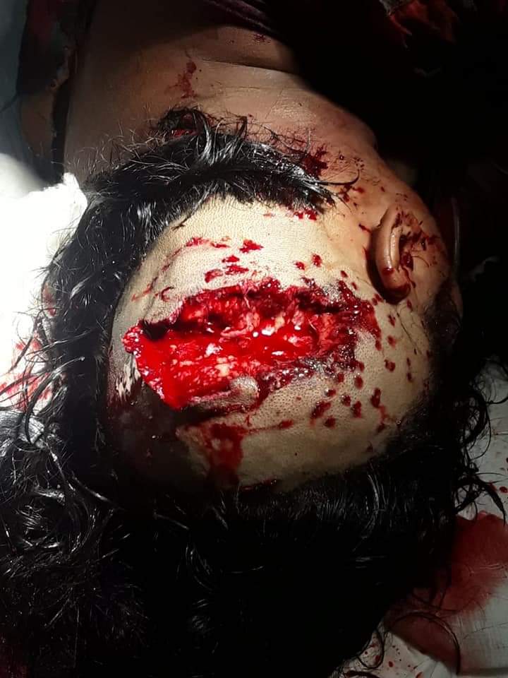 KhanSaumitra's tweet photo. 😭😭😭😭😭😭বলার ভাষা নেই। দিদি এটা কোন গনতন্ত্র?  @MamataOfficial @BanglarGorboMB https://t.co/PqxoJdh6kJ