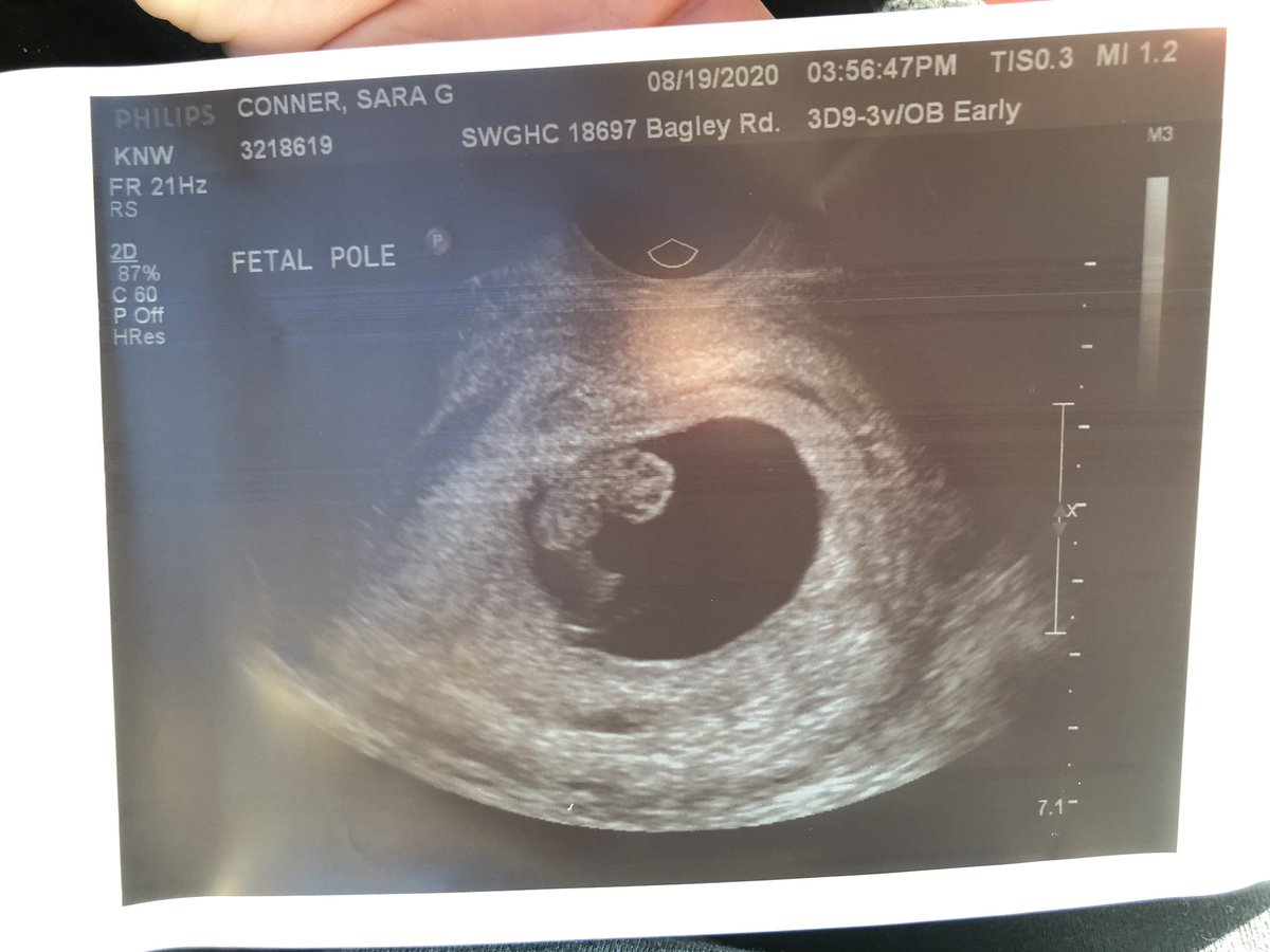 SaraConner24's tweet photo. March can’t come fast enough 🤰🏼❤️ #BabyNumberThree #Family https://t.co/cD2sAQ6YeO