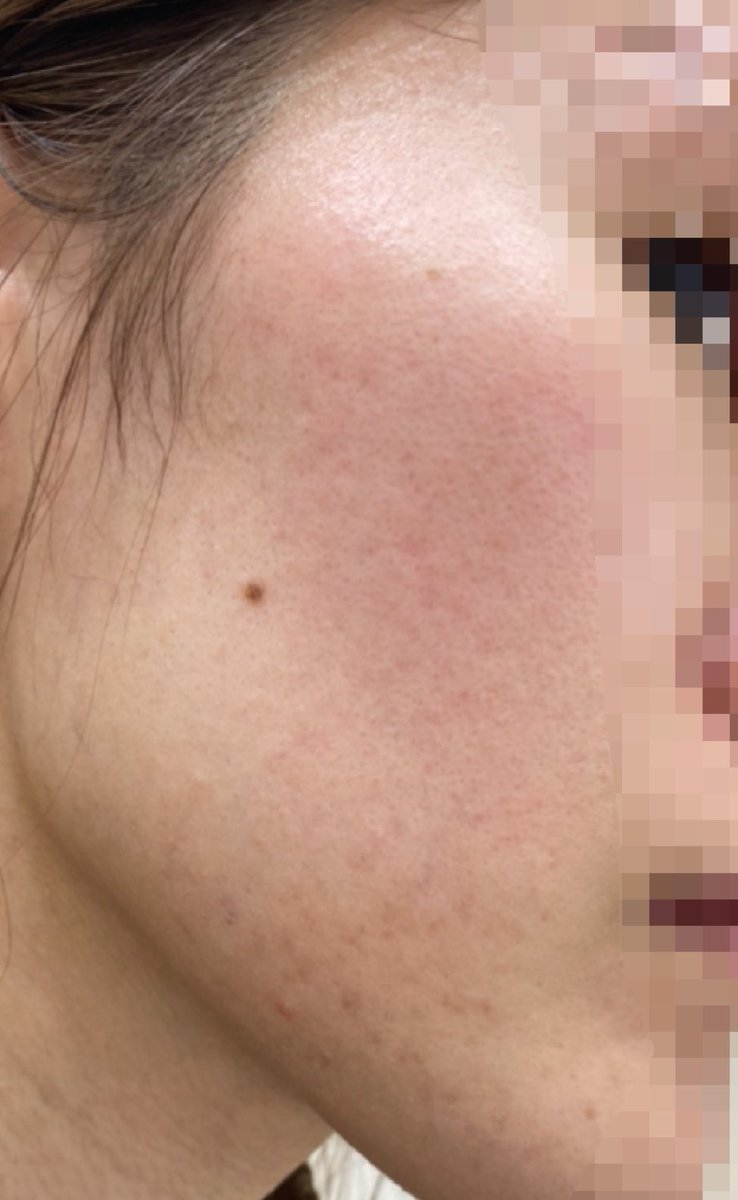 美容追求オンナのアカウント Jhhpq2jzbtus0dj Twitter