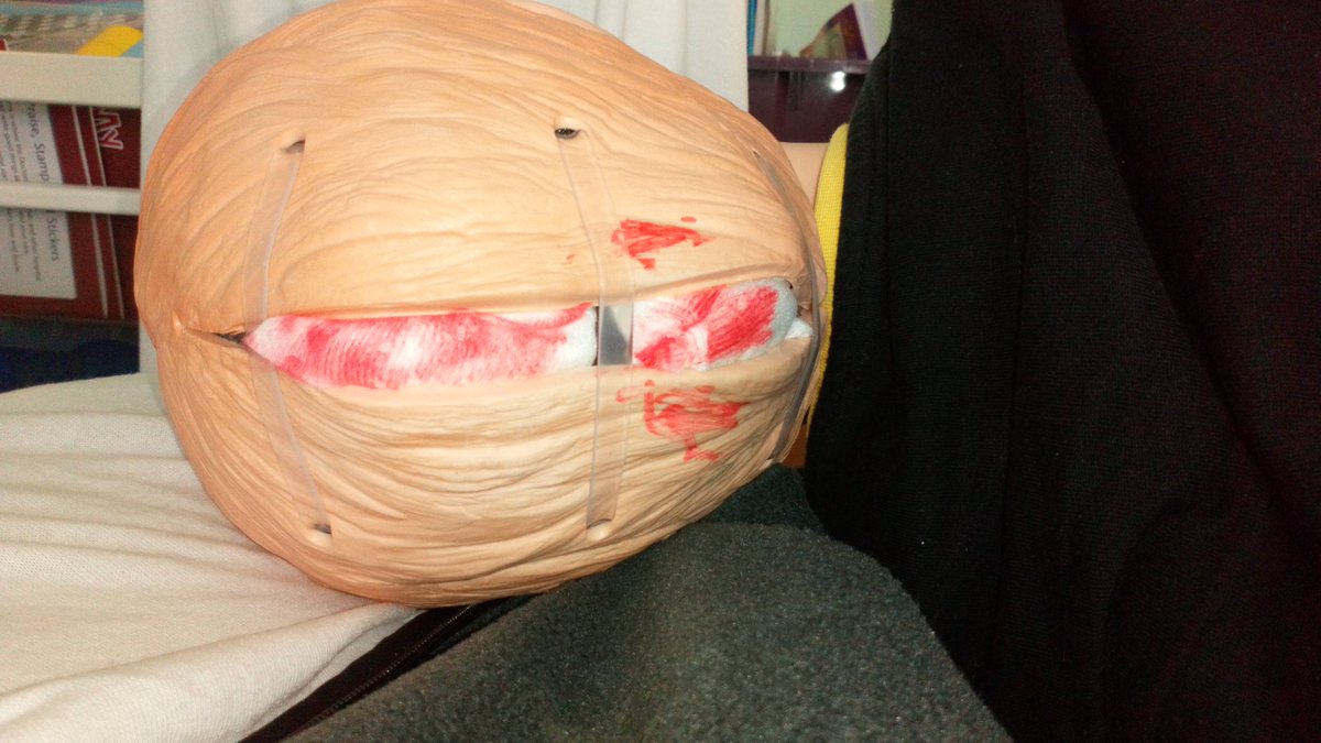 PaedMedEd's tweet photo. Full marks to Edinburgh Med Students in Simulation today on unconscious child in @NHSBorders Didn't fall for the distracting head injury &amp; didn't forget the glucose #defg Didnt even need the extra clue! @EdinUniMedicine @mededborders https://t.co/zPIRzOL1h2