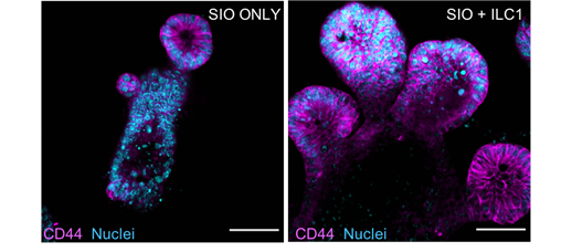 We found that ILC1 unexpectedly drove growth of enlarged CD44+ epithelial  #stem cell crypts. This was mediated by ILC1-derived TGFβ1, which specifically upregulated CD44 splice variant 6 across the entire crypt. (see also brilliantfrom 1st author  @GeraldineJowett) (4/25)