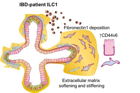 So, in summary, ILC1 secrete TGFβ1, driving proliferation of CD44v6+ epithelial crypts, as well as extracellular matrix remodelling (also through IBD biomarker MMP9) when co-cultured with gut organoids. (21/25)