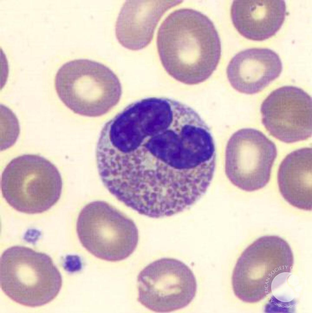 Blood cells are recognizable by their nuclear patterns. Most neutrophils have 3 or 4 lobes connected by thin strands of chromatin-free nucleoplasm, while eosinophils are usually bilobed. Basophil nuclei have 2 lobes, but granules are so dark it can sometimes be hard to see./5