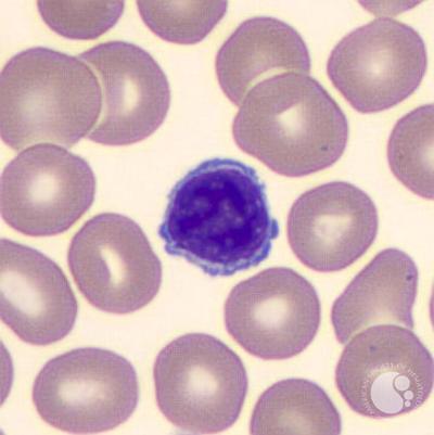 The “mononuclear” leukocytes include lymphocytes and monocytes. Lymphocyte nuclei are usually more condensed and round. Monocyte nuclei (which are actually usually “bilobed” - cleaved or kidney shaped - not “mono” lobed!) change shape when they differentiate into macrophages./6