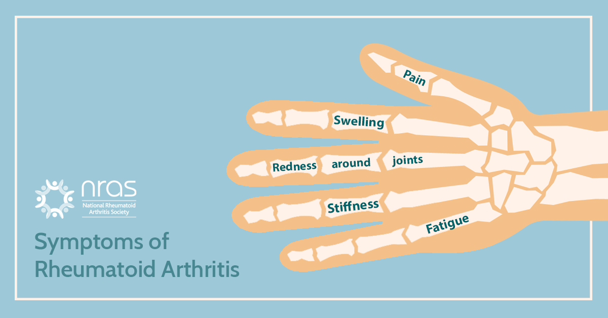 NRAS_UK's tweet photo. Rheumatoid Arthritis (RA) is an autoimmune condition which is where the body's immune system attacks part of the body itself.

In RA, the immune system attacks the lining of the joints causing inflammation which leads to symptoms such as pain and stiffness.

#RAAW2020 https://t.co/F6mYvo2vYy