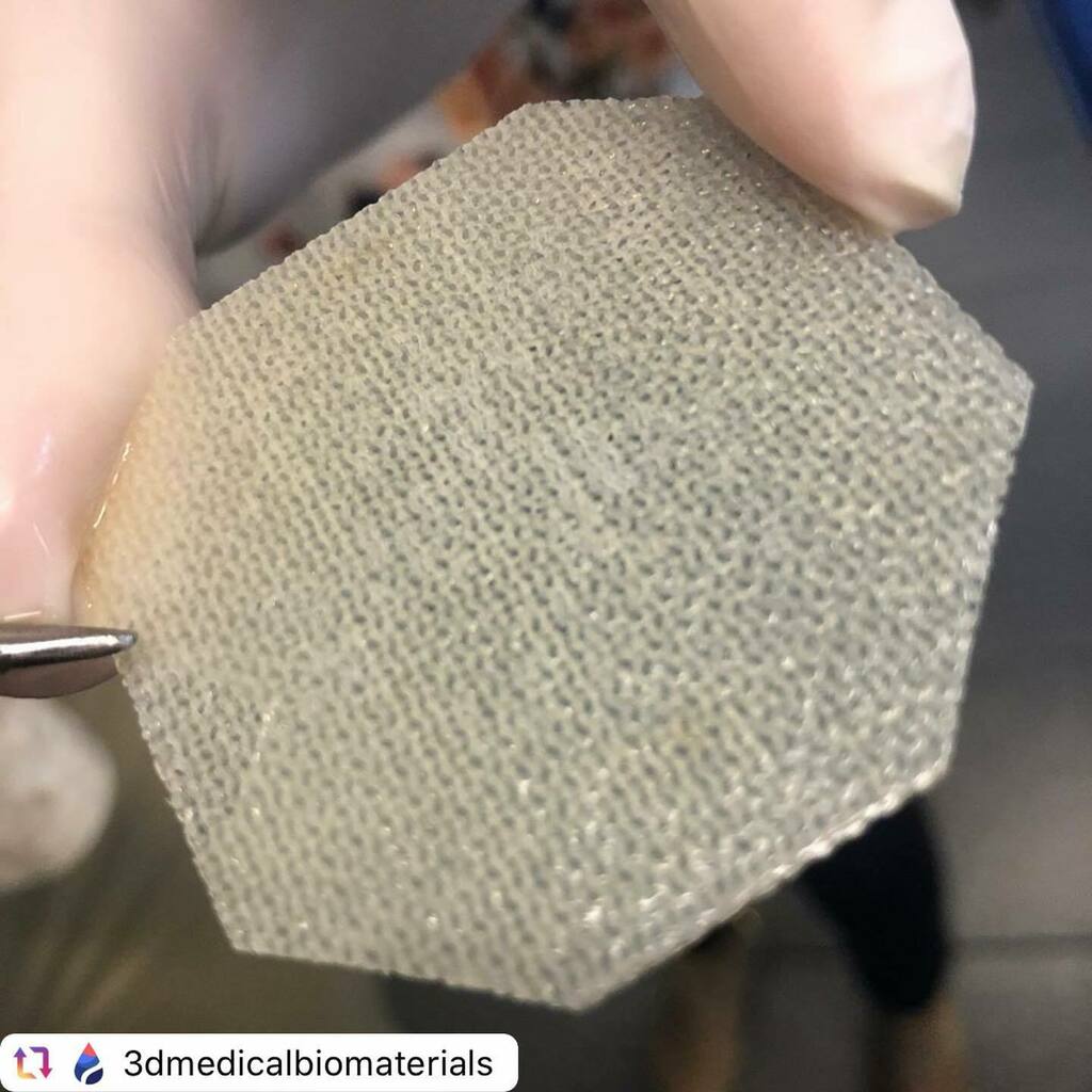 3dheals's tweet photo. #Repost @3dmedicalbiomaterials with @reposter.app
.
Scaffold for tissue regeneration. Made by DME3D team. advancedbiomaterials 3dscaffold #3dprinting #3dprintinginmedicine #3dprintingmedical #3dmedical #3dmedicalprinting #3dmedicalprint #3dmedicalexpo #3dmedicalmodel #3dmedi… https://t.co/ghmw81lVd7