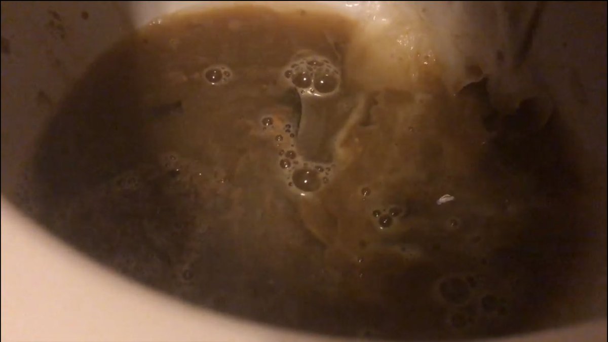 LogGoddess's tweet photo. It’s finally done! 🥰 I made an over 10 minute long compilation of all kinds of dumps - from firm logs to diarrhea blowouts, with flushes, my moans~ the whole package! 💖 
I’m super, super proud of this video, if you’re interested in buying it DM me! 🥳

#scat #scatvideo #female https://t.co/vFLzYGTa5e