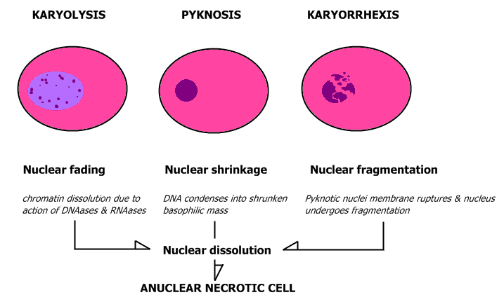 OK enough food. Nucleli blow up in various ways. In addition to apoptosis, there is karyorrhexis from Greek κάρυον, "kernel, seed or nucleus" & ῥῆξις "bursting”, pyknosis (from Greek word πυκνός "to thicken up, to condense", and karyolysis where the nucleus just dissolves./40