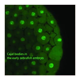 The nucleus also has 1-10 "Cajal bodies", also called coiled bodies, similar size to PML bodies. They look like tangled thread under EM. They’re important in RNA processing, too. This image is from the Neugebauer lab  @Yale. Named after Spanish anatomist Santiago Ramón y Cajal/45