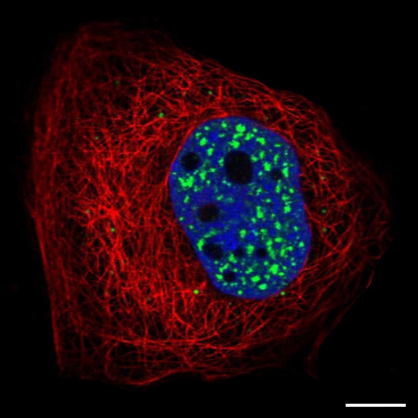 And “splicing speckles”, aka snurposomes, are dynamic structures enriched in pre-mRNA splicing factors. On EM, they look like interchromatin granules. “Paraspeckles” are found next to speckles. I think it is safe to say we’ve only just begun to understand the nucleus./48