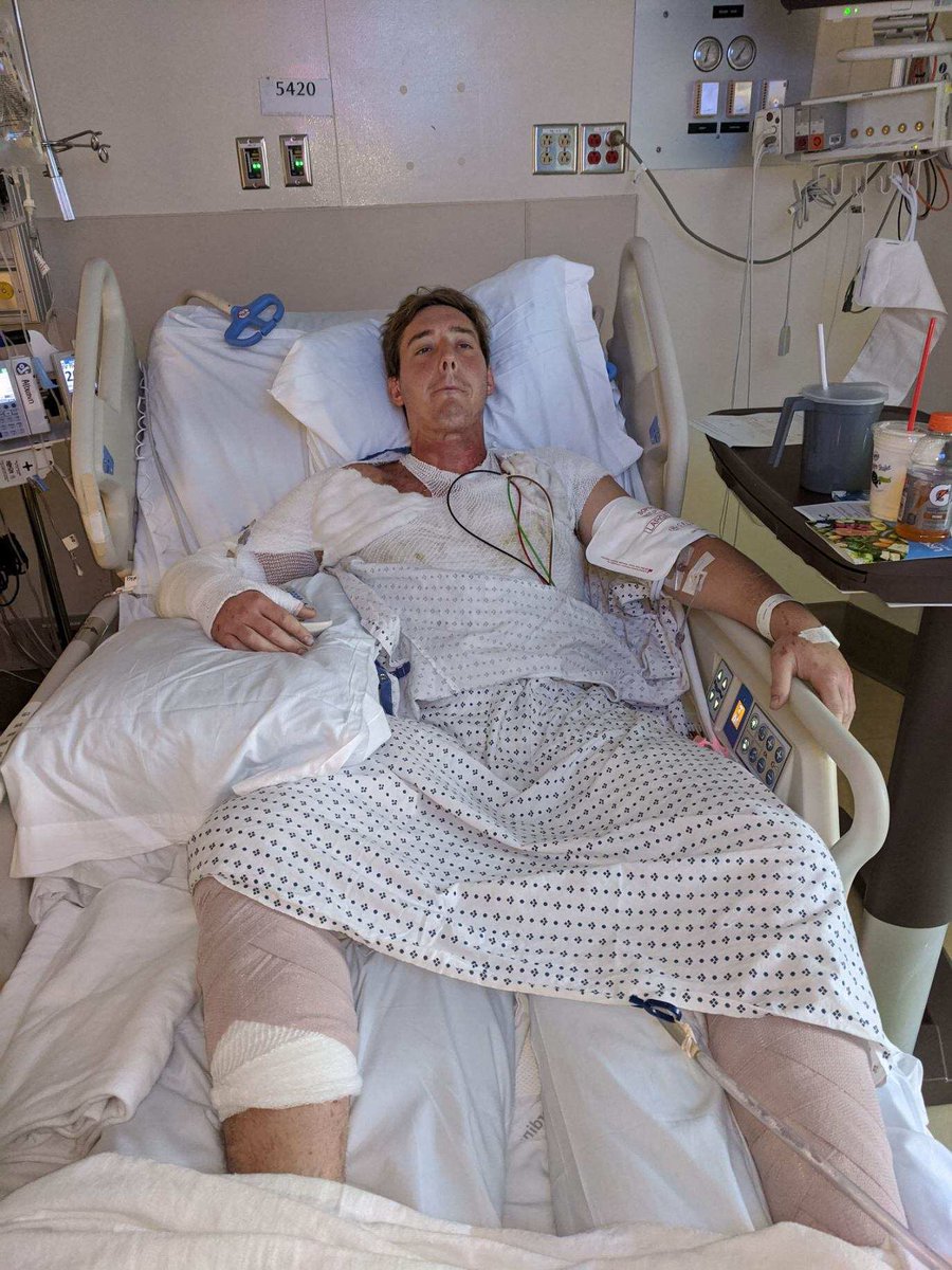 Daanielle10's tweet photo. Hi everyone my bf blake was in a horrible accident Saturday and over 50% of his body is burned and we desperately need any help we can get even if it’s a prayer 🥺https://t.co/WlR3hB5e8o https://t.co/FsRkP0E420