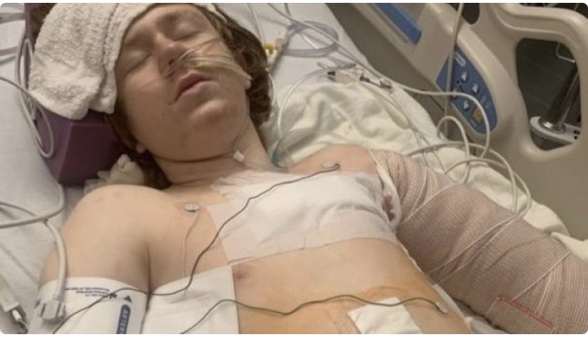 JusticeforBPC's tweet photo. This is Linden, the 13 year old shot by police on September 4th in Glendale!!! His family is facing insane medical bills!!! Their go-fund me is in my bio if you have anything you could contribute!!! Sending all my support n strength to the family!!! https://t.co/60bKKkfuRy