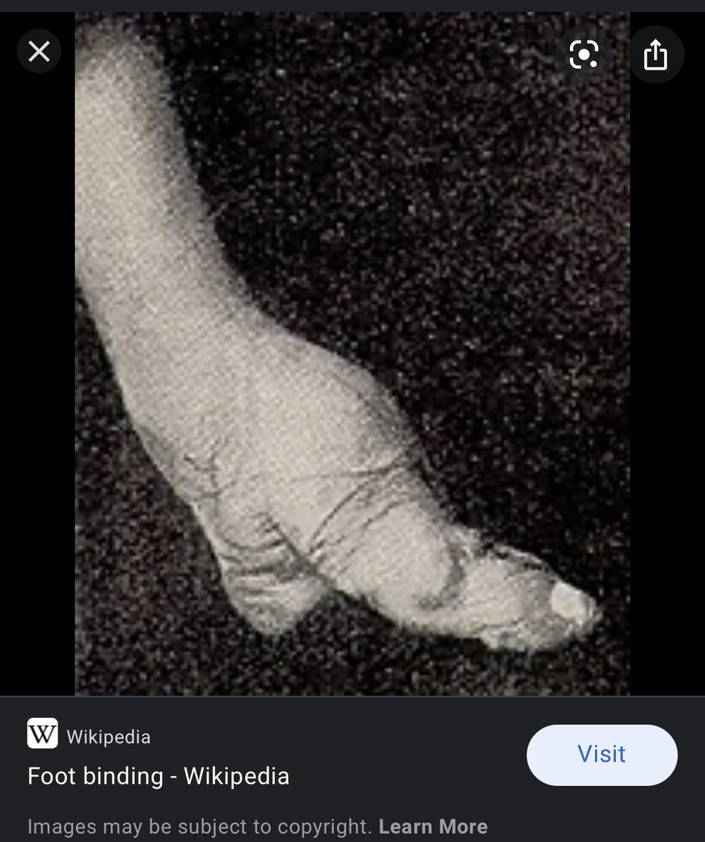 lori_dauwalder's tweet photo. My feet after wearing heels all day https://t.co/DTyeGshlfo